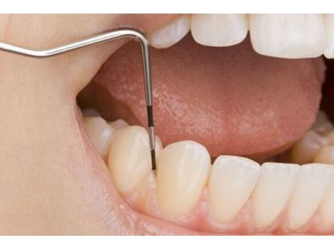 Tratamento para Dente de Leite na Teotônio Vilela